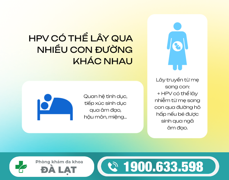 Hình ảnh minh họa